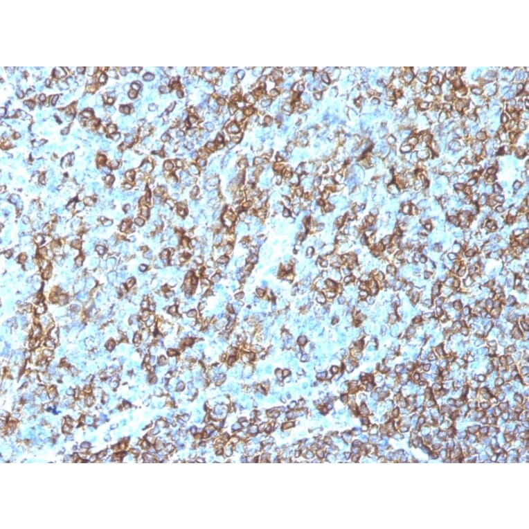 Immunohistochemistry - Anti-HLA DRB Antibody [LN-3] (A248851) - Antibodies.com