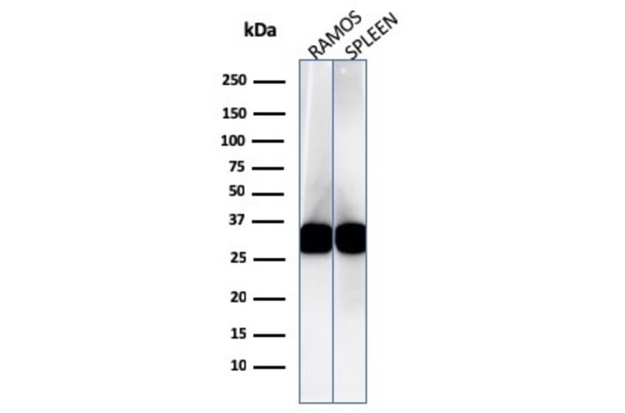 Western Blot - Anti-HLA DRB Antibody [LN-3] (A248851) - Antibodies.com