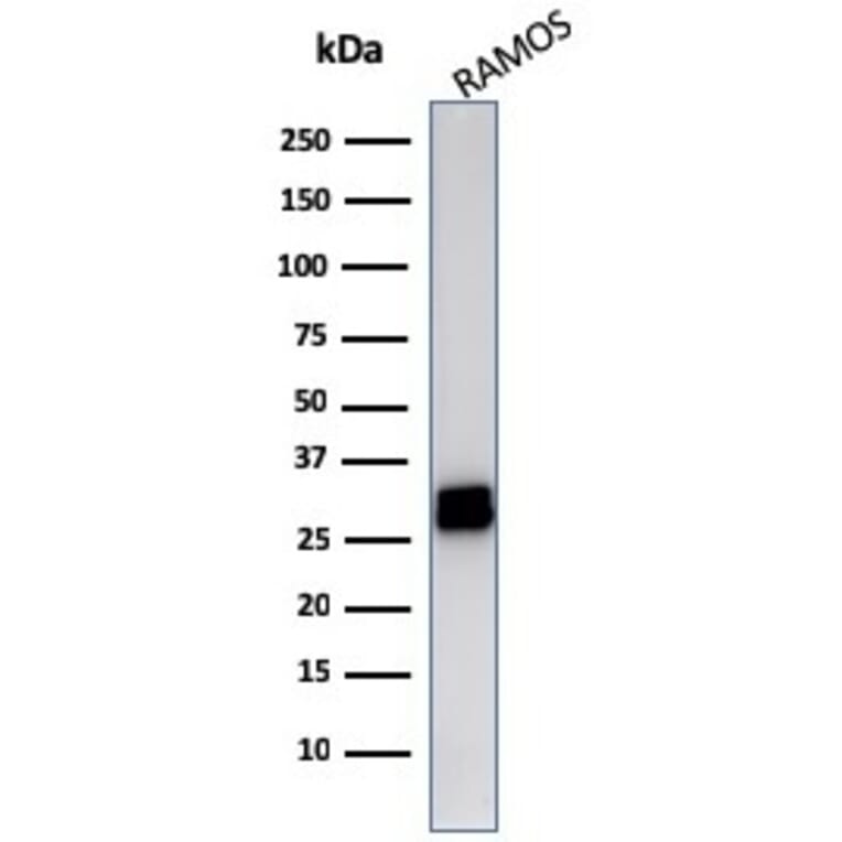 Western Blot - Anti-HLA DRB Antibody [LN-3] (A248851) - Antibodies.com
