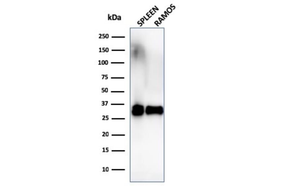 Western Blot - Anti-HLA DRB Antibody [SPM289] (A252033) - Antibodies.com