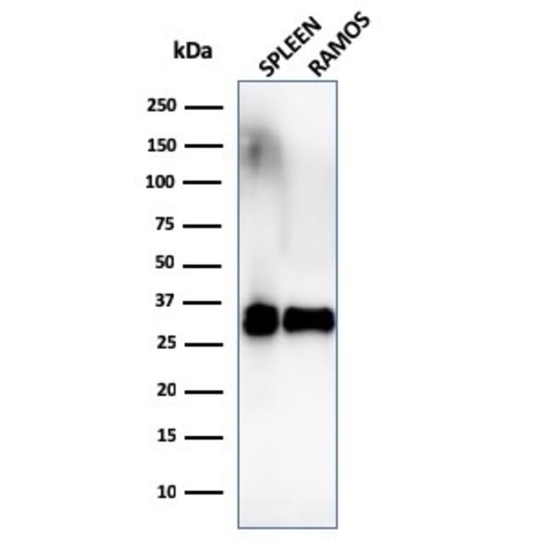 Western Blot - Anti-HLA DRB Antibody [SPM289] (A252033) - Antibodies.com