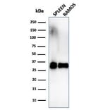 Western Blot - Anti-HLA DRB Antibody [SPM289] (A252033) - Antibodies.com