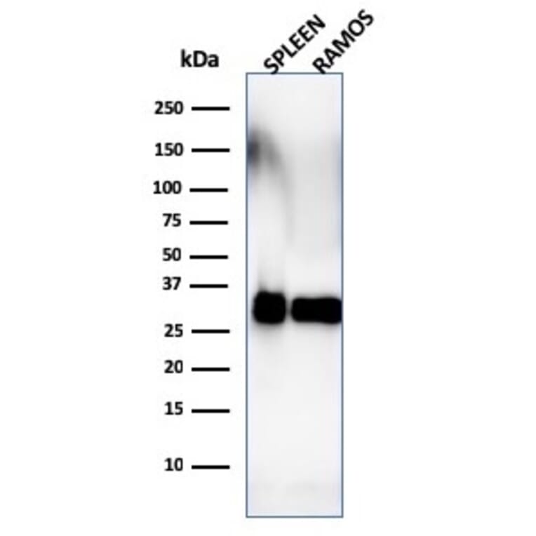 Western Blot - Anti-HLA DRB Antibody [SPM288] (A248853) - Antibodies.com