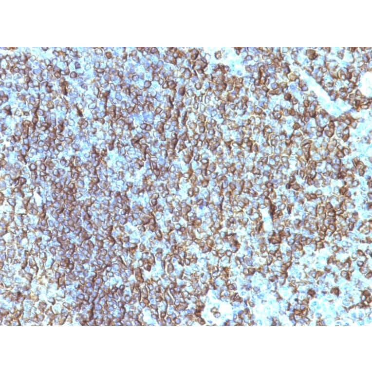 Immunohistochemistry - Anti-HLA DRB Antibody [SPM288] (A248853) - Antibodies.com