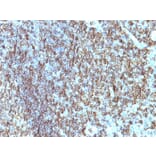 Immunohistochemistry - Anti-HLA DRB Antibody [SPM288] (A248853) - Antibodies.com