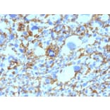 Immunohistochemistry - Anti-HLA DRB Antibody [SPM423] (A252031) - Antibodies.com