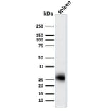 Western Blot - Anti-HLA DRB Antibody [SPM423] (A252038) - Antibodies.com