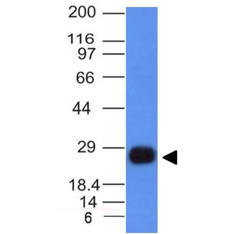 Western Blot - Anti-HLA DRB Antibody [HLA-DRB/1067] (A248855) - Antibodies.com