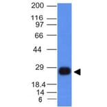 Western Blot - Anti-HLA DRB Antibody [HLA-DRB/1067] (A248855) - Antibodies.com