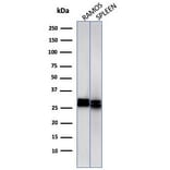 Western Blot - Anti-HLA DRB Antibody [HLA-DRB/1067] (A248855) - Antibodies.com
