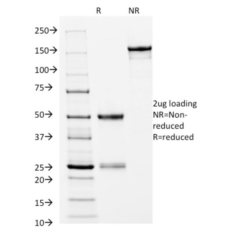 SDS-PAGE - Anti-HLA DRB Antibody [L243] (A248855) - Antibodies.com