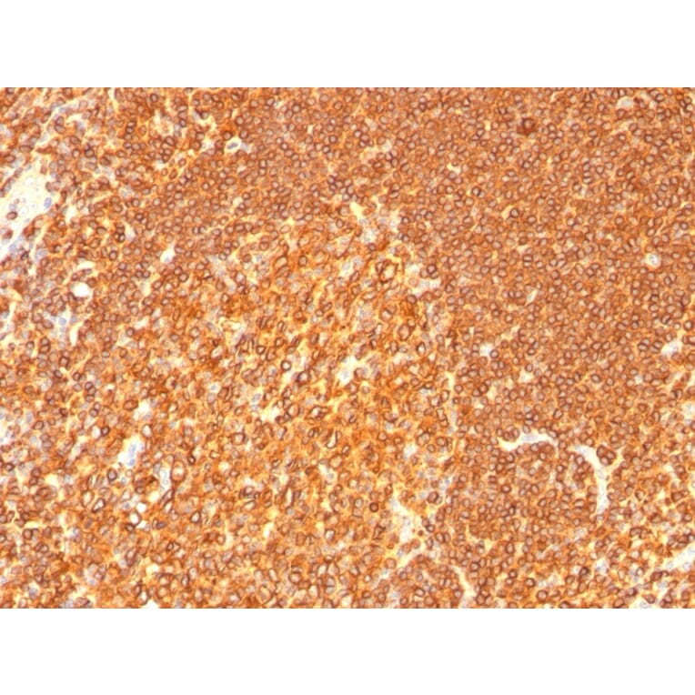 Immunohistochemistry - Anti-HLA DRB Antibody [LN-3 + HLA-DRB/1067] (A252035) - Antibodies.com
