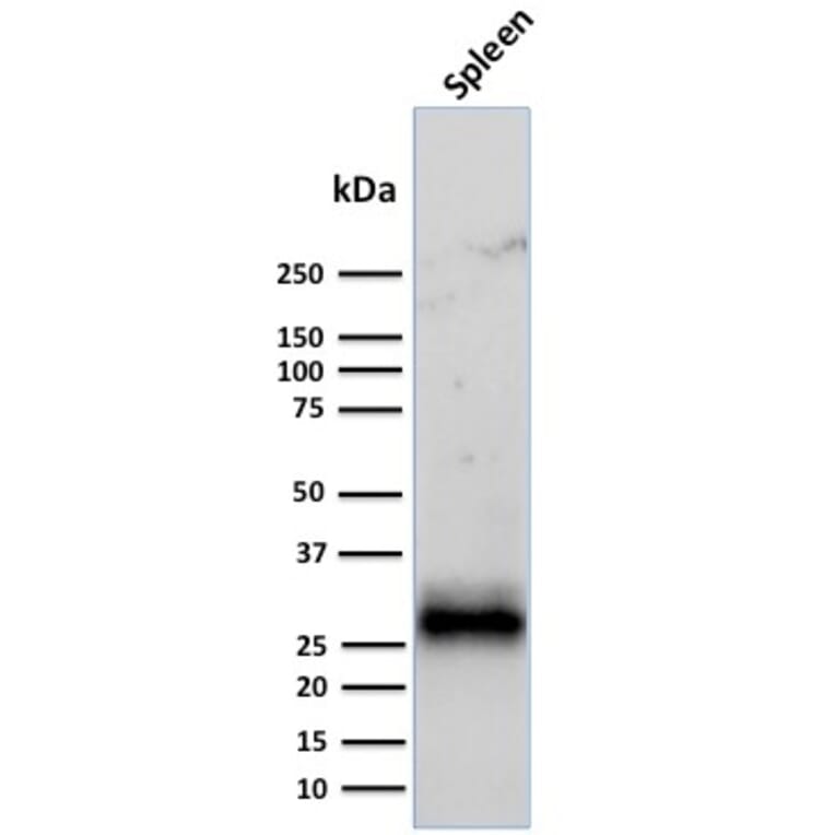 Western Blot - Anti-HLA DRB Antibody [LN-3 + HLA-DRB/1067] (A252009) - Antibodies.com