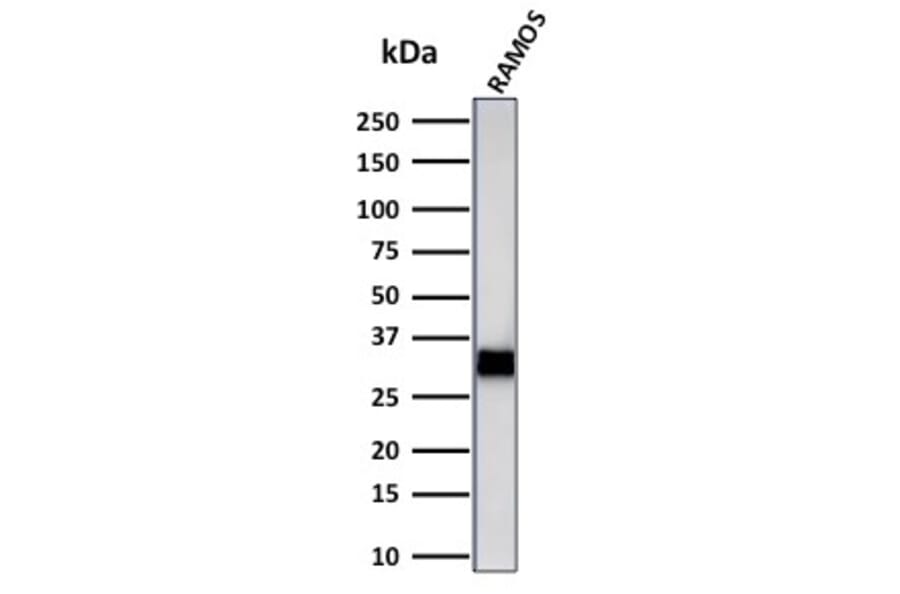 Western Blot - Anti-HLA DRB Antibody [LN-3 + HLA-DRB/1067] (A252035) - Antibodies.com
