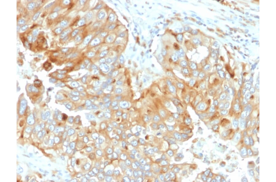 Immunohistochemistry - Anti-HLA DRB Antibody [DA2] (A248858) - Antibodies.com