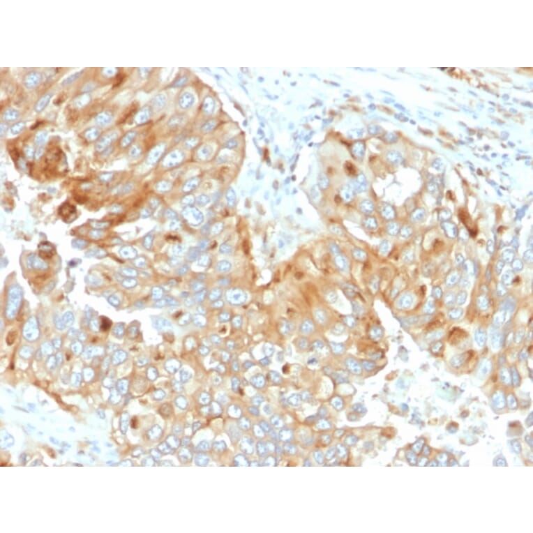 Immunohistochemistry - Anti-HLA DRB Antibody [DA2] (A248858) - Antibodies.com