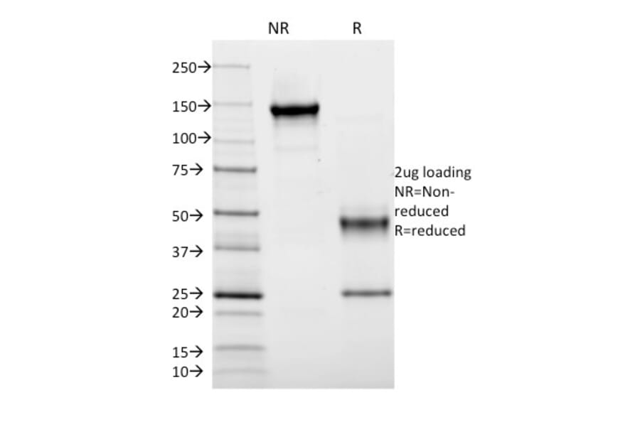 SDS-PAGE - Anti-HLA DRB Antibody [DA2] (A248859) - Antibodies.com