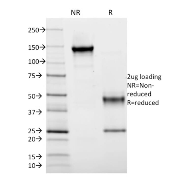 SDS-PAGE - Anti-HLA DRB Antibody [DA2] (A248859) - Antibodies.com