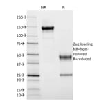 SDS-PAGE - Anti-HLA DRB Antibody [DA2] (A248859) - Antibodies.com