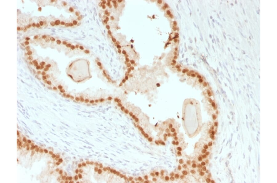 Immunohistochemistry - Anti-FOXA1 Antibody [rFOXA1/1515] (A248860) - Antibodies.com