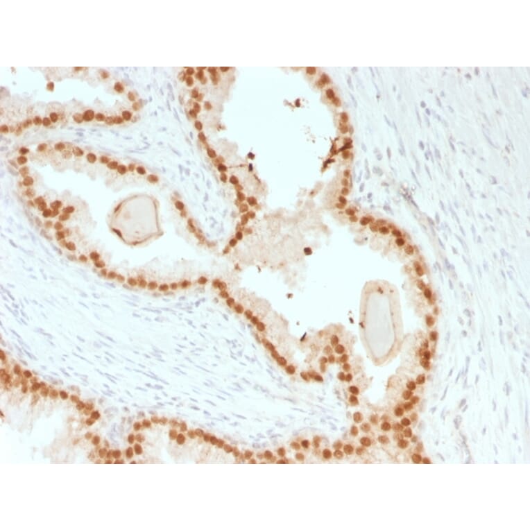 Immunohistochemistry - Anti-FOXA1 Antibody [rFOXA1/1515] (A248860) - Antibodies.com
