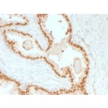 Immunohistochemistry - Anti-FOXA1 Antibody [rFOXA1/1515] (A248860) - Antibodies.com