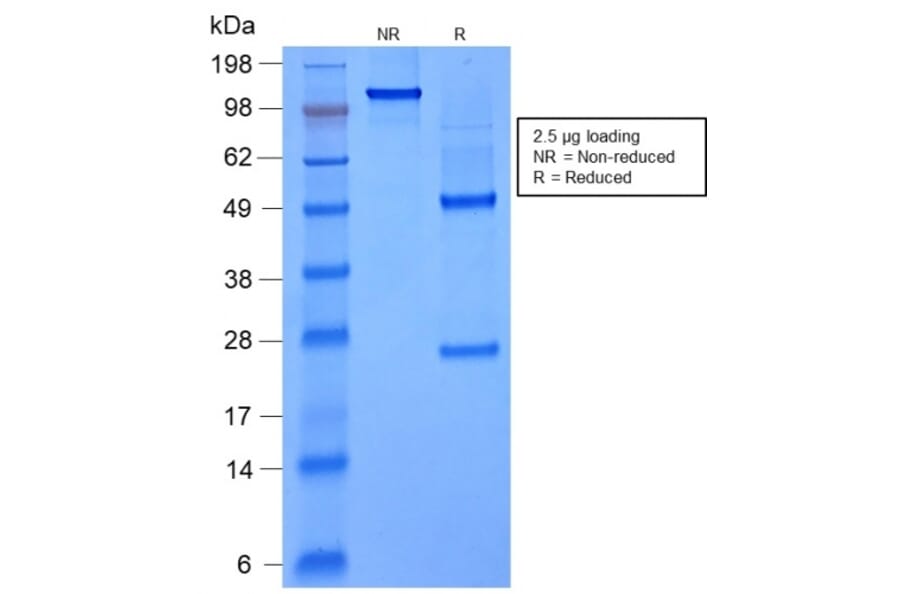 SDS-PAGE - Anti-FOXA1 Antibody [rFOXA1/1515] (A248860) - Antibodies.com