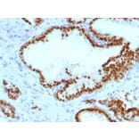 Immunohistochemistry - Anti-FOXA1 Antibody [FOXA1/1241] (A248861) - Antibodies.com