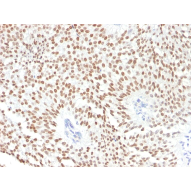 Immunohistochemistry - Anti-FOXA1 Antibody [FOXA1/1241] (A248861) - Antibodies.com
