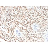 Immunohistochemistry - Anti-FOXA1 Antibody [FOXA1/1241] (A248861) - Antibodies.com
