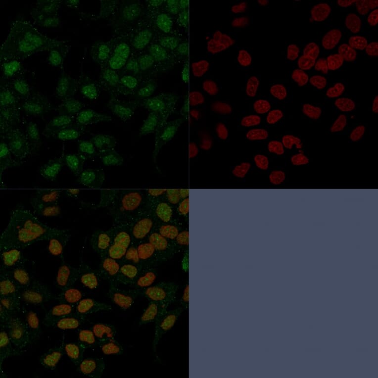 Immunofluorescence - Anti-FOXA1 Antibody [FOXA1/1241] (A248861) - Antibodies.com