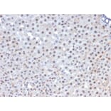Immunohistochemistry - Anti-FOXA1 Antibody [FOXA1/1241] (A248861) - Antibodies.com