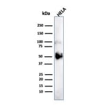Western Blot - Anti-FOXA1 Antibody [FOXA1/1241] (A248861) - Antibodies.com