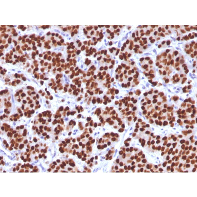 Immunohistochemistry - Anti-FOXA1 Antibody [FOXA1/1512] (A248862) - Antibodies.com