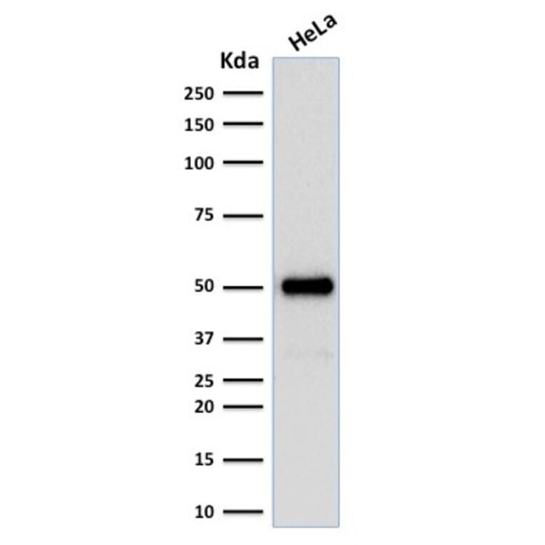Western Blot - Anti-FOXA1 Antibody [FOXA1/1512] (A248862) - Antibodies.com