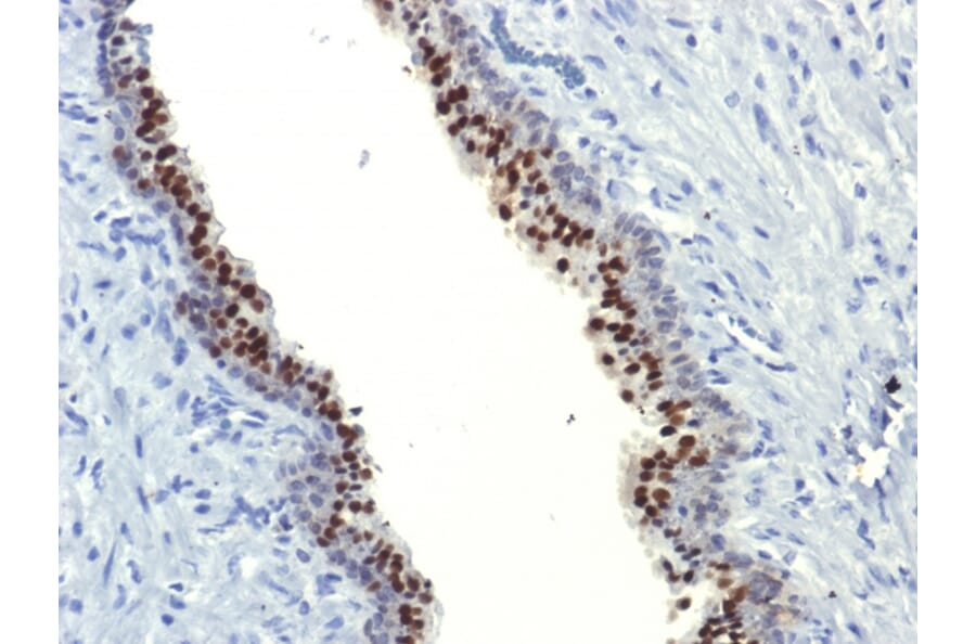 Immunohistochemistry - Anti-FOXA1 Antibody [FOXA1/1514] (A248863) - Antibodies.com