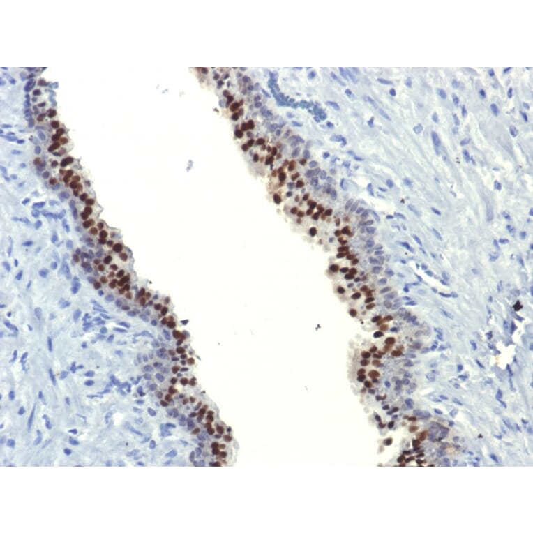 Immunohistochemistry - Anti-FOXA1 Antibody [FOXA1/1514] (A248863) - Antibodies.com