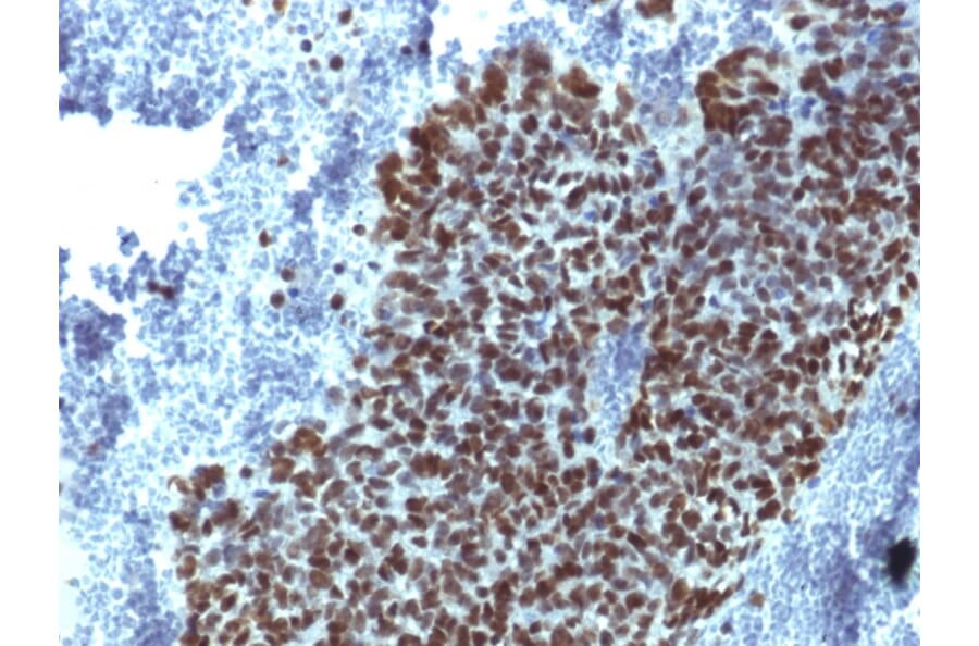 Immunohistochemistry - Anti-FOXA1 Antibody [FOXA1/1514] (A248862) - Antibodies.com