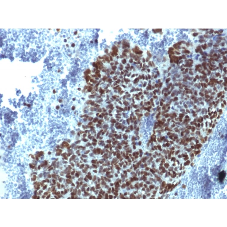 Immunohistochemistry - Anti-FOXA1 Antibody [FOXA1/1514] (A248862) - Antibodies.com