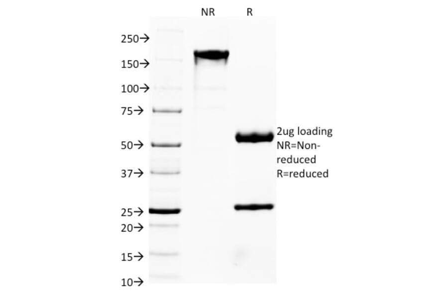 SDS-PAGE - Anti-FOXA1 Antibody [FOXA1/1514] (A248863) - Antibodies.com