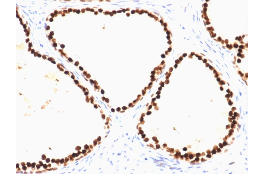 Immunohistochemistry - Anti-FOXA1 Antibody [FOXA1/1515] (A248864) - Antibodies.com