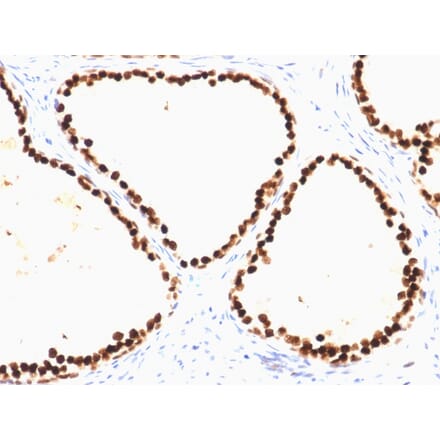 Immunohistochemistry - Anti-FOXA1 Antibody [FOXA1/1515] (A248864) - Antibodies.com