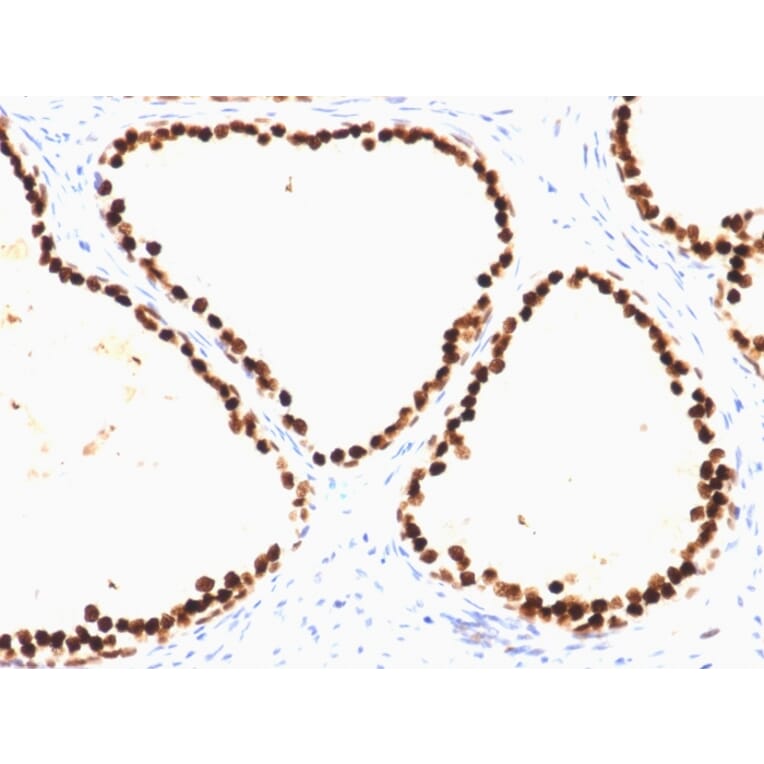 Immunohistochemistry - Anti-FOXA1 Antibody [FOXA1/1515] (A248864) - Antibodies.com