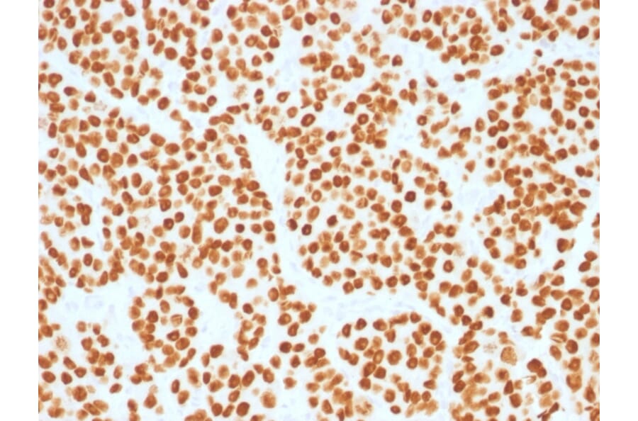 Immunohistochemistry - Anti-FOXA1 Antibody [FOXA1/1515] (A248864) - Antibodies.com