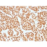 Immunohistochemistry - Anti-FOXA1 Antibody [FOXA1/1515] (A248864) - Antibodies.com