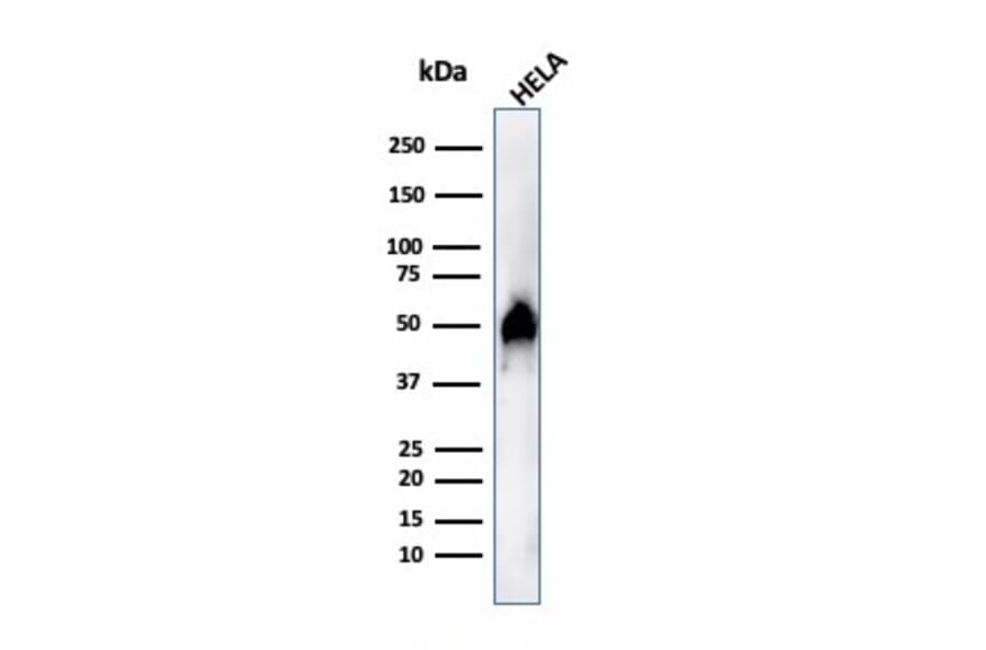 Western Blot - Anti-FOXA1 Antibody [FOXA1/1515] (A248864) - Antibodies.com