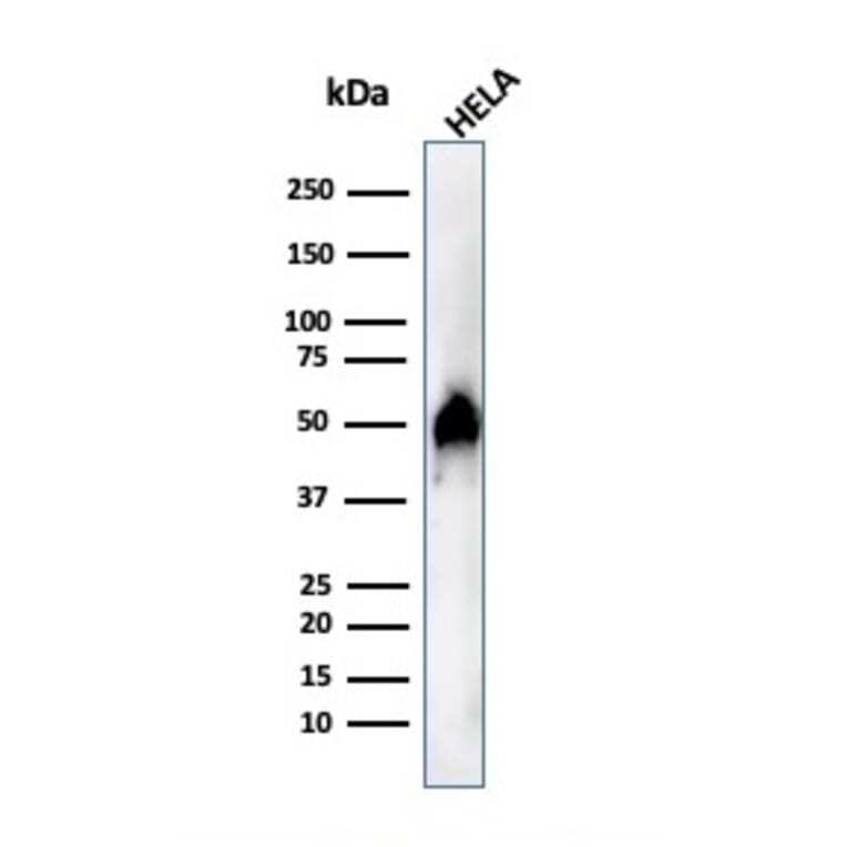 Western Blot - Anti-FOXA1 Antibody [FOXA1/1515] (A248864) - Antibodies.com