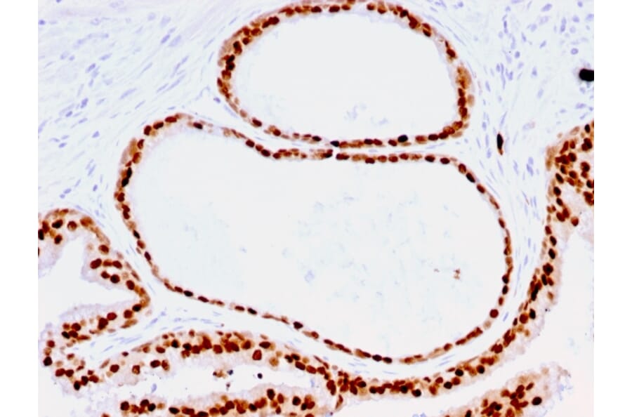 Immunohistochemistry - Anti-FOXA1 Antibody [FOXA1/1516] (A248865) - Antibodies.com