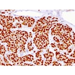 Immunohistochemistry - Anti-FOXA1 Antibody [FOXA1/1516] (A248864) - Antibodies.com