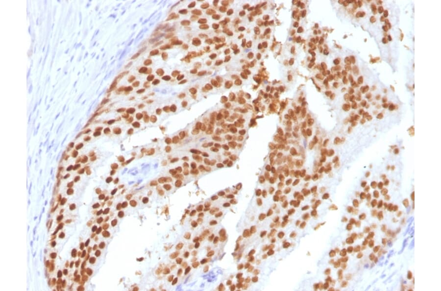 Immunohistochemistry - Anti-FOXA1 Antibody [FOXA1/1516] (A248865) - Antibodies.com